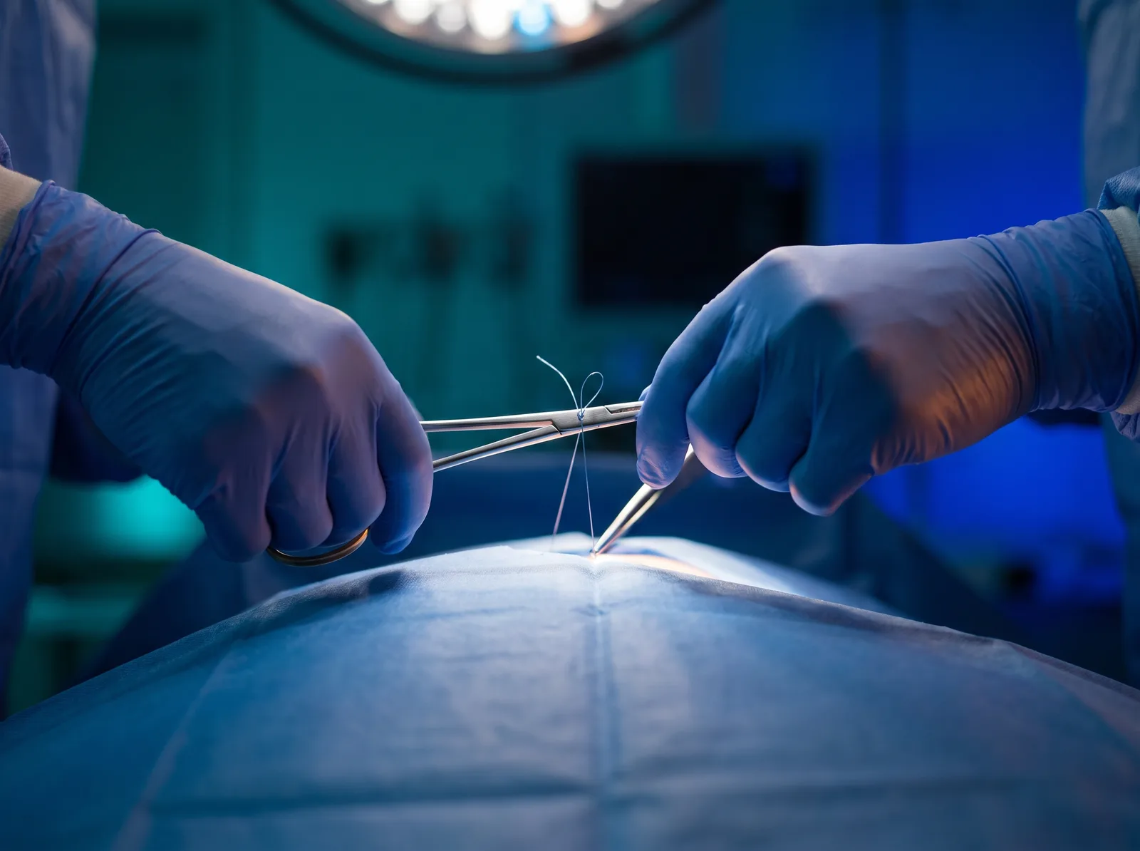 Two gloved hands closing tissue at a small opening in a blue surgical drape, one holding a needle driver and the other holding forceps with a loop of suture drawn up between them.