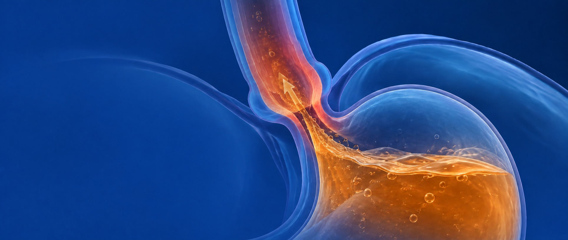 Translucent anatomical rendering of the junction where the esophagus meets the stomach, with acid rising from the stomach shown in amber against a royal blue field.